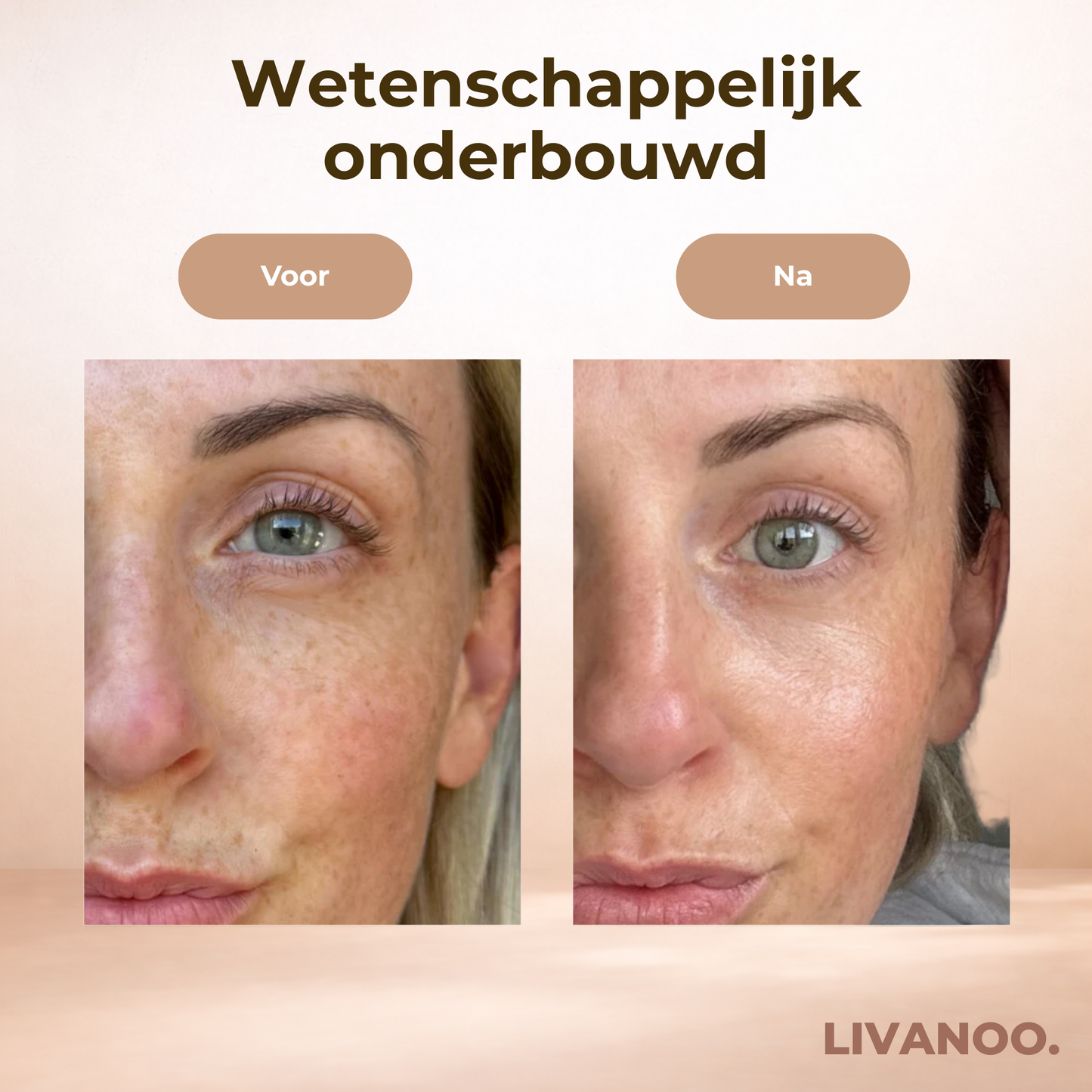 Livanoo • Lichttherapie Masker Pro